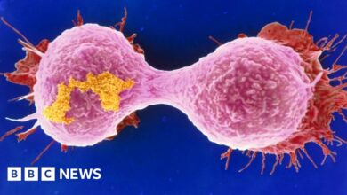 99658714 breastcancer cell spl.jpg