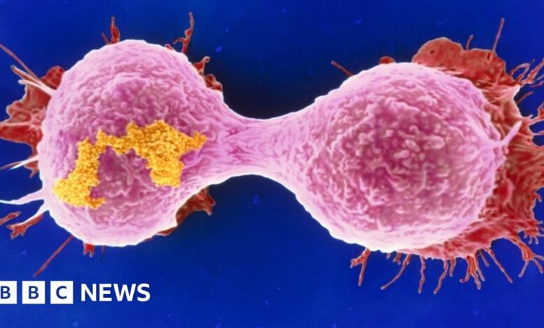 99658714 breastcancer cell spl.jpg