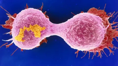 Science Photo Library Dividing breast cancer cell