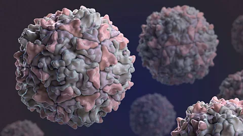 Polio, or poliomyelitis, is caused by a virus and mainly affects children under 5 years of age (Science Photo Library)