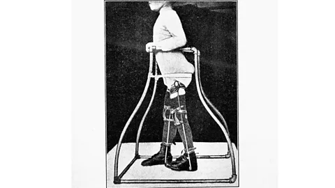 Paralysed child strapped in a walking frame wearing splints to prevent forward dropping of the knee (Wellcome Library)